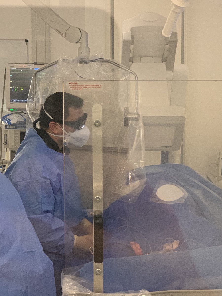 Special day at Essex CTC today. ORBITA2 randomisation in lab 1 and simultaneously ORBITA CTO randomisation in cath lab 2. We are getting good at placebo controlled pci ! Can’t wait for both trial results. @rallamee @CCook_MD @rajkumar_chris @dr_skhan1 @essexheartfund