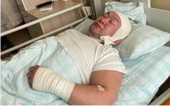 Найзыгаа үхтэл зодчихоод өөрийгөө битүү богоод эмнэлэгт очиж хэвтэж бгаад ингээд зураг аа авахуулдаг ОЙГҮЙ ТЭНЭГ ХӨЛДҮҮ ХҮНИЙ АДАГ шүү.