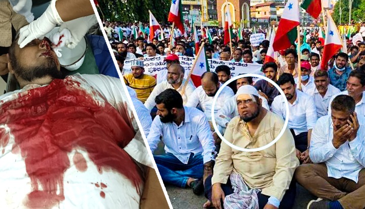 oma_salam's tweet photo. His head still high. Just two days back this brother was brutally assaulted by Mangalore police for demanding justice. He is back on the streets today right from the hospital. I am humbled. Do you think you can win over a people with this kind of determination and perseverance? https://t.co/TLuhVelKeB