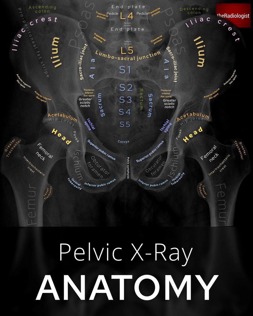 AP view Pelvic X-Ray Anatomy