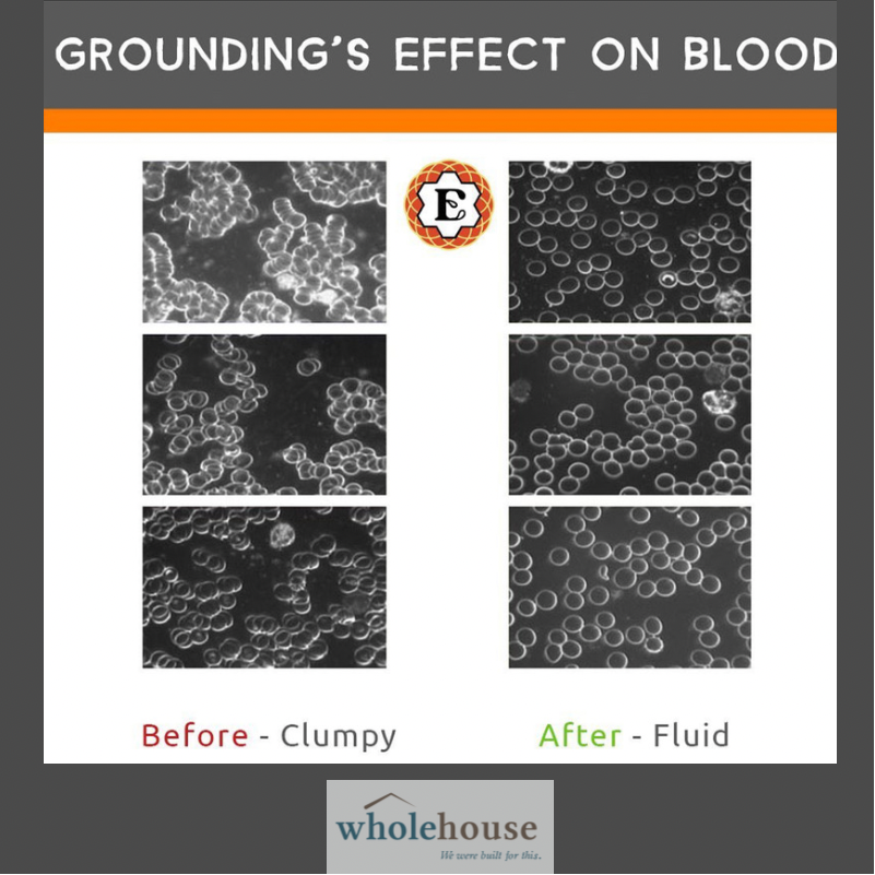 WholeHouseCC's tweet photo. Grounding is cool (and healthy). Do more grounding! 
Not only is it proven to help increase cardiovascular health but it’s also been proven to help sleep, overall mood and decrease stress. Check out all the facts: https://t.co/NadGnBadQM https://t.co/0MfVFXY8Ku