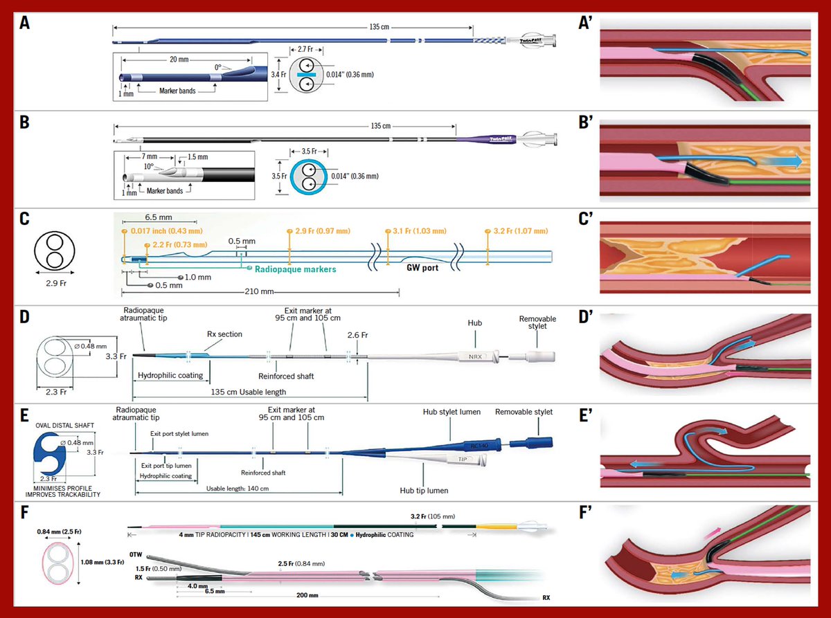 This consensus document of the Euro-CTO Club describes the technical characteristics and use of  commercially available dual lumen microcatheters. #EAPCI ow.ly/Iwx250He63x