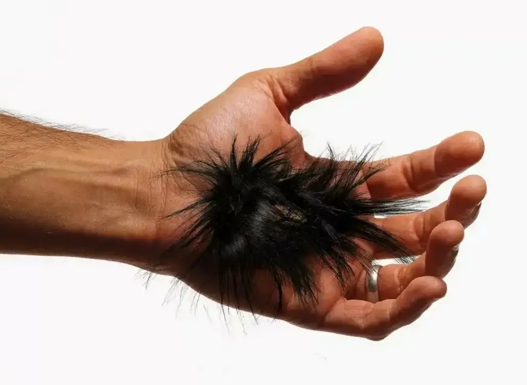 волосатые пальцы у девушки. мохнатые пальцы. мохнатые пальцы. страшные пальцы нсногах. мохнатые пальцы.