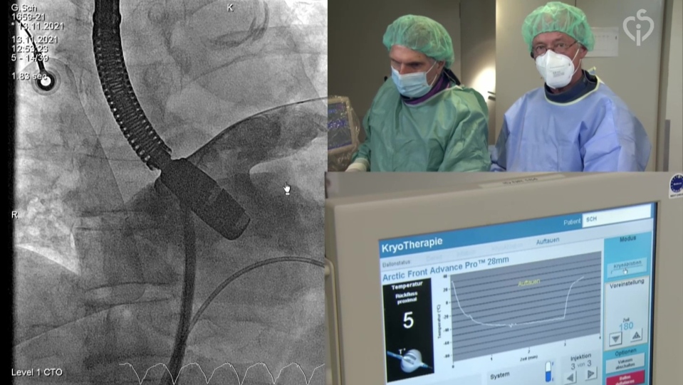 CSIcongress's tweet photo. Watch the new #Podcase of the Month:
"LAA closure with Amplatzer™ Amulet™ LAA Occluder" from #CSIFocusLAA.
📺https://t.co/WaQwv0k1nL
#Cardiology #CardioEd #LiveCase #CardioTwitter https://t.co/rcOQ5wAGLz