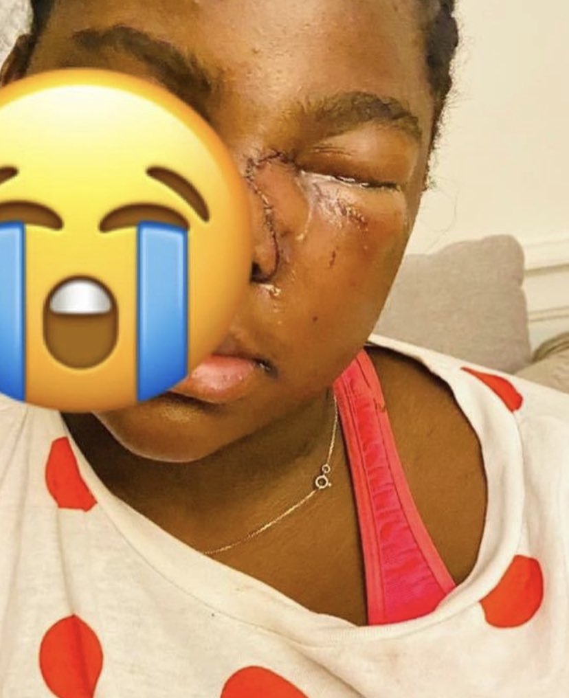 GuiraudInd's tweet photo. 🚨 Je vous invite à partager le témoignage terrible de la maman d’Anna-Chloé sur sa fille victime de racisme à l’école

La réaction de l’école est en dessous de tout ! Aucun soutien, aucune recherche sérieuse de la vérité… Le racisme brise des petits, agissons ! https://t.co/2xMqGHkt05
