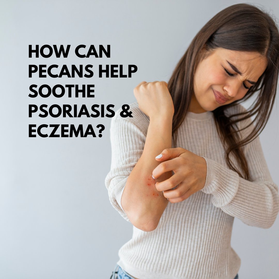 Nuez Acres (NuezAcres) Twitter