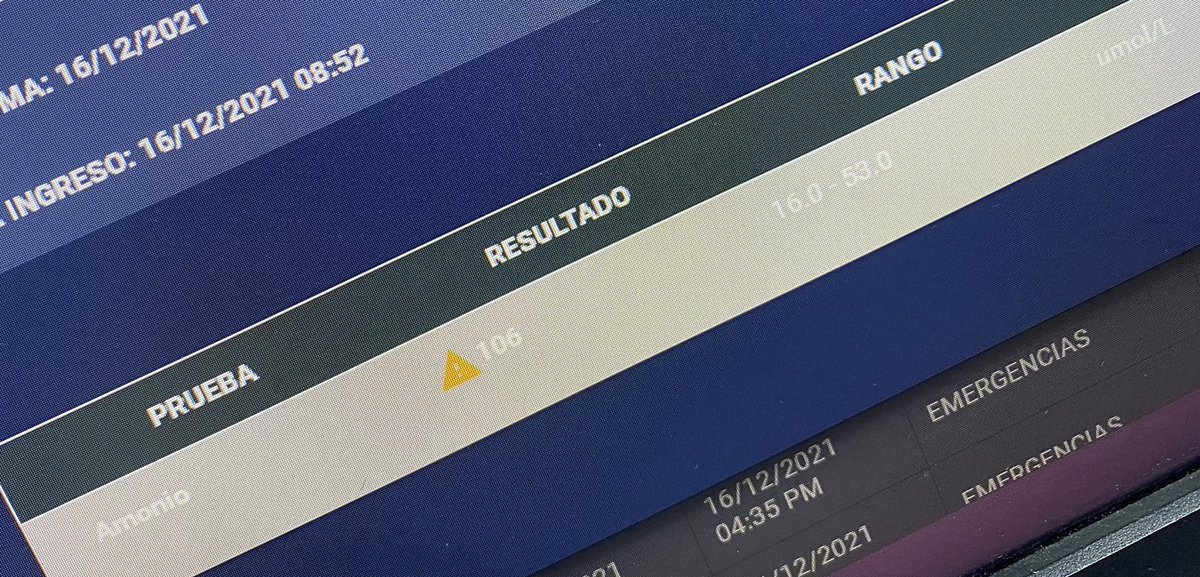 CarlosJosRomer3's tweet image. Nunca pensé que usaría carnitina junto a carbapenémicos para manejar una encefalopatía, pero sirvió. Bueno, también le puse un poco de bicarbonato por la amplitud de esa R en avR.😅