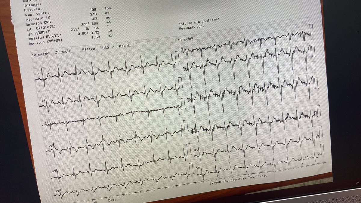 CarlosJosRomer3's tweet image. Nunca pensé que usaría carnitina junto a carbapenémicos para manejar una encefalopatía, pero sirvió. Bueno, también le puse un poco de bicarbonato por la amplitud de esa R en avR.😅
