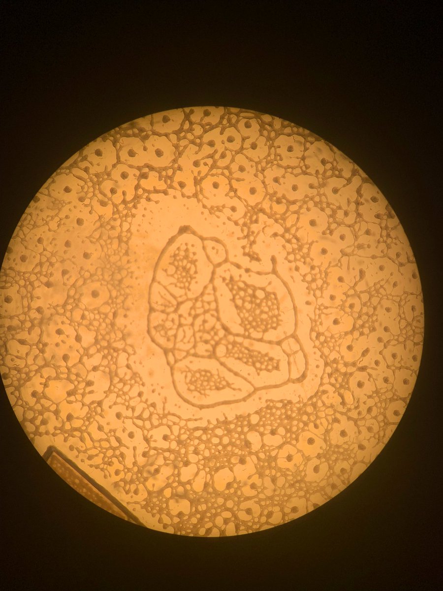 Cleaning out the old plates for winter break and found some all natural worm art. I need a shirt with this pattern stat!  #Wormart #Labshutdown