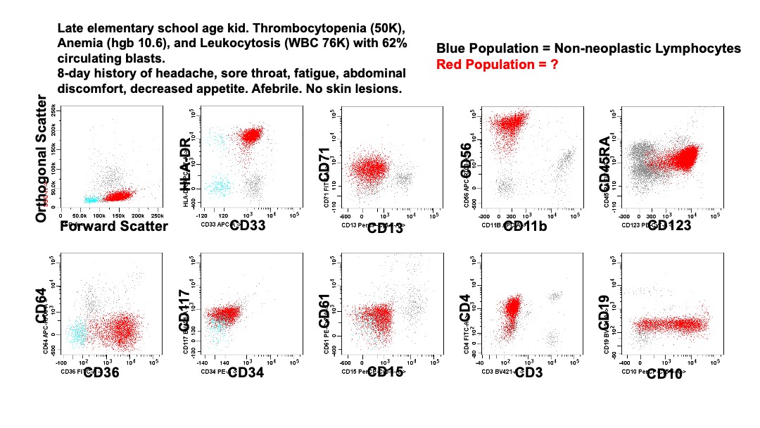 Nitin Karandikar (@pathimmune) on Twitter photo A weekend flow case after a long time.... Here is a quick-and-dirty slide (sorry for the expeditious cluttered labeling). History on the slide.
What do you think about the red population?
#GoWithTheFlow
<a href="/UIPathology/">University of Iowa Pathology</a> A weekend flow case after a long time.... Here is a quick-and-dirty slide (sorry for the expeditious cluttered labeling). History on the slide.
What do you think about the red population?
#GoWithTheFlow
<a href="/UIPathology/">University of Iowa Pathology</a>