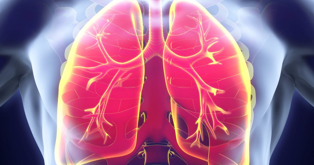 PulmonaryApps's tweet photo. Cleveland Clinic evaluates ways to reduce use of broad-spectrum antibiotics in adults with community-acquired pneumonia via @ClevelandClinic https://t.co/ZW63cVP4hY #antiviral #antibiotics #pneumonia #krystalklear #pulmonaryapps https://t.co/I2oHq2SnWE