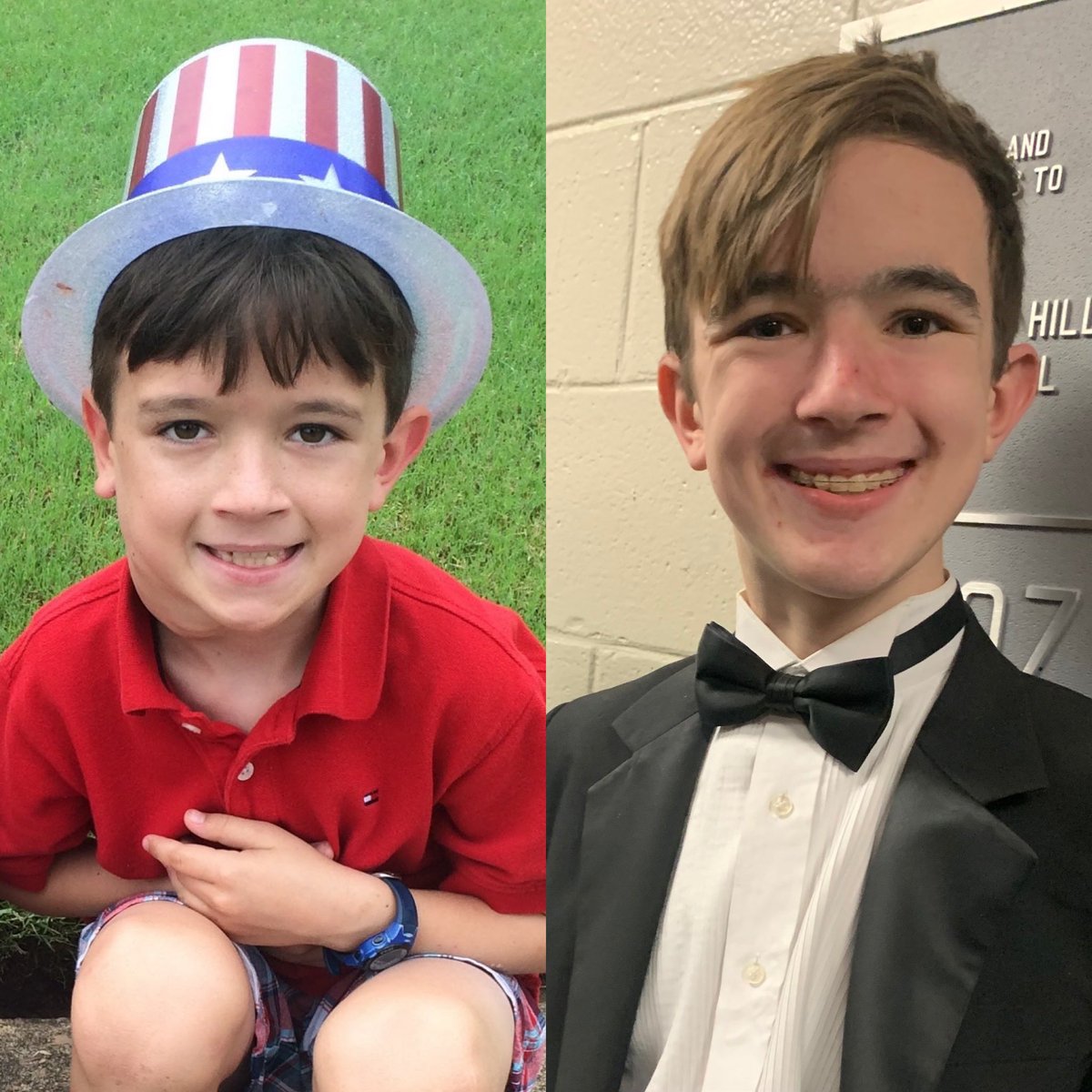 2015: Our 9 year old son was predicted to need tracheostomy due to his growing NF1 plexiform. December 2021: he is 16 and singing baritone in his high school choir. Thankful for our @NCI_CCR_PedOnc MEK wonder team! #endnf #clinicaltrials #mekworks