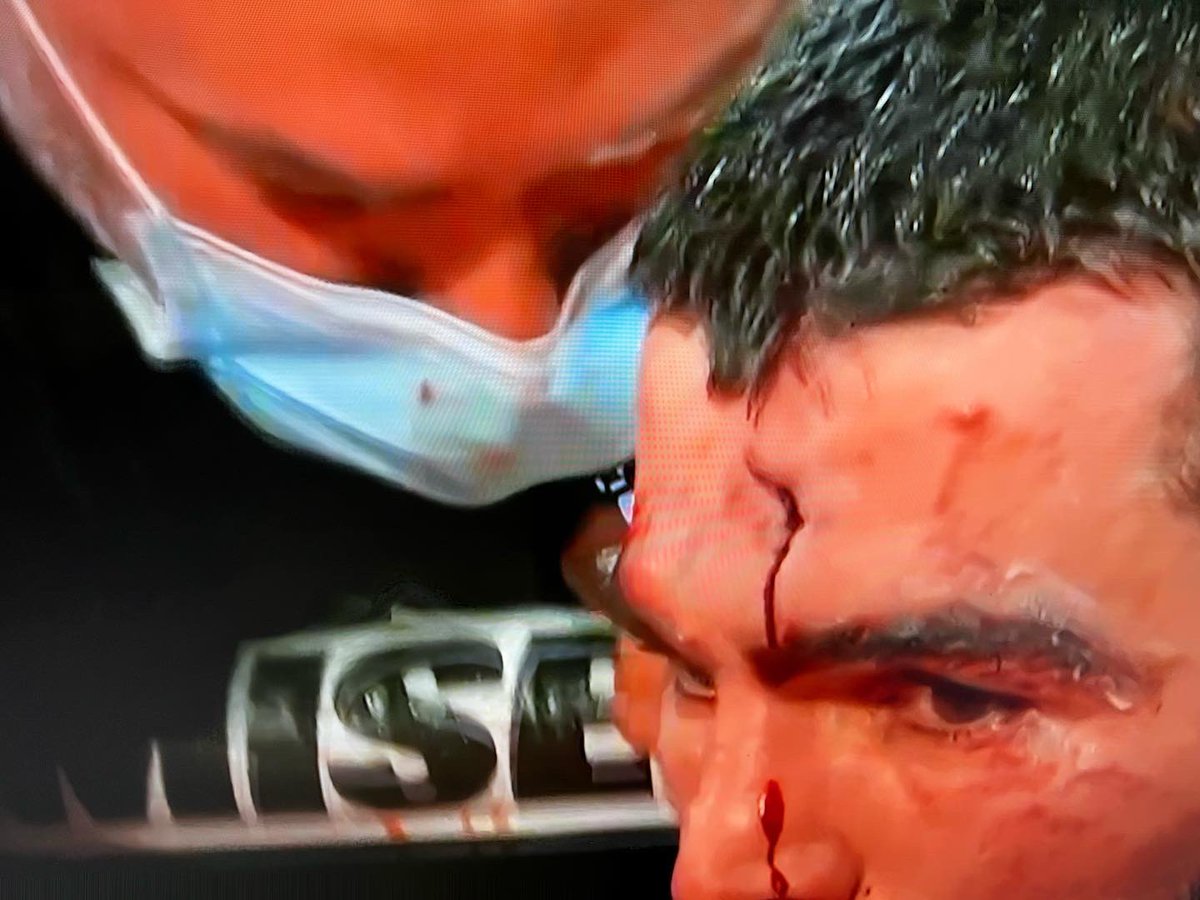 weighinboxing1's tweet photo. Should the Doctors or Commission stopped this fight??? Arthur Beterbiev vs Marcus Browne #beterbievbrowne #theweighin #worldclassboxing https://t.co/wOXVdwK9qA