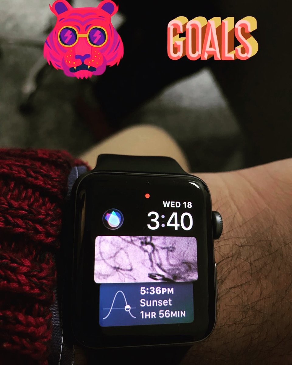 KothiwalaNeal's tweet photo. Apple Watch sending me beautiful memories.
Secured aneurysm is best feeling for neurosurgeon. #AppleWatch #aneurysmclipping #cerebralangiogram https://t.co/0pLpBngIYT
