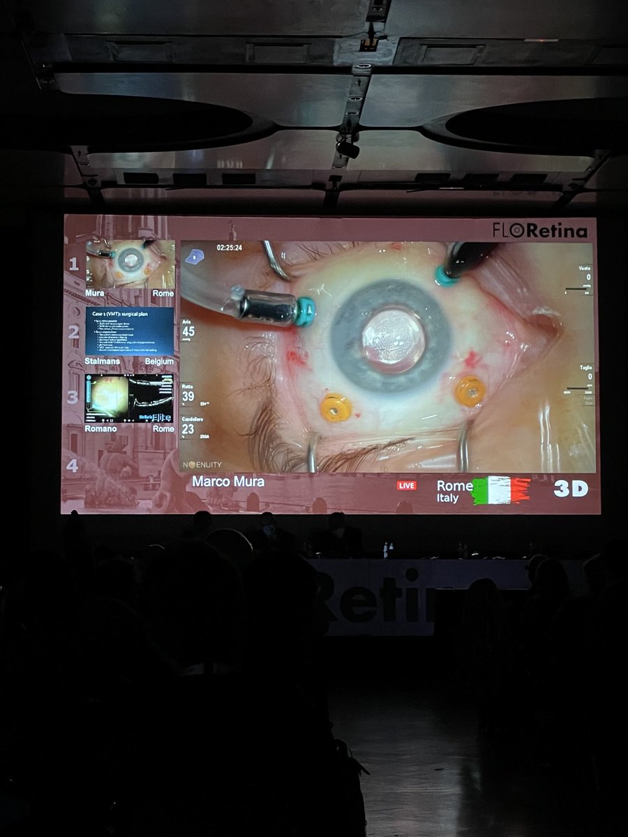 davidscsousa's tweet photo. #FLORetina 2021
After these last 2 years, it has been great to catch up again with friends and colleagues in Rome to share the present and future of vitreoretinal surgery https://t.co/SS27HWSP4m