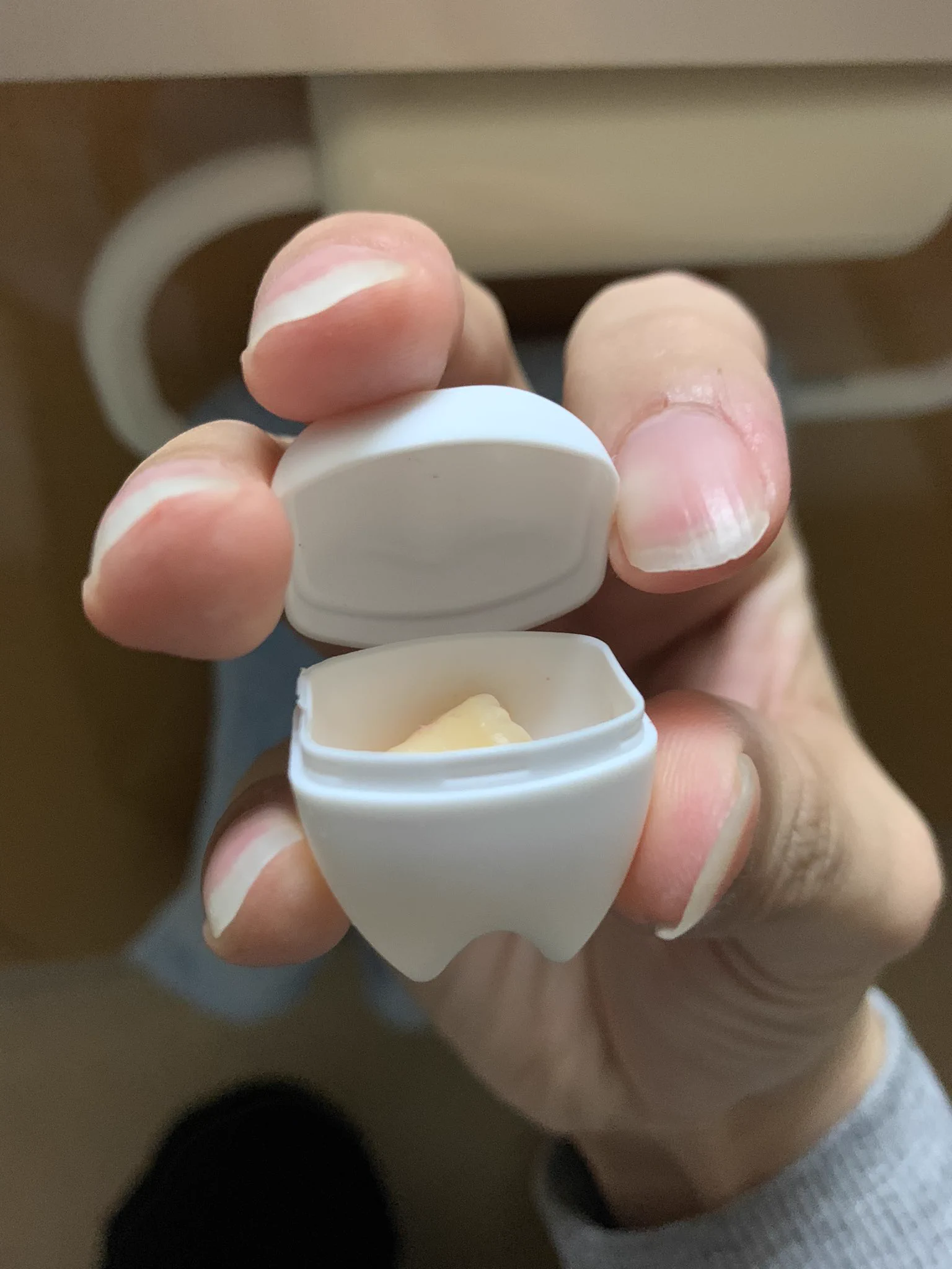 抜歯記念日になりそう！かわいいケースで持ち帰り