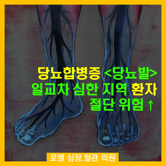 당뇨발 진짜 위험하던데... 지역에 따라 위험이 나눠지는건가? "당뇨합병증 <당뇨발> 일교차 심한 지역 환자 절단 위험 ↑ "(연구) #심장혈관전문의 #로엘의원 naver.me/FmU8k9f9