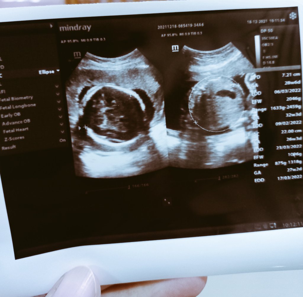 Sehat-sehat ya cintaku 🤗😍💞