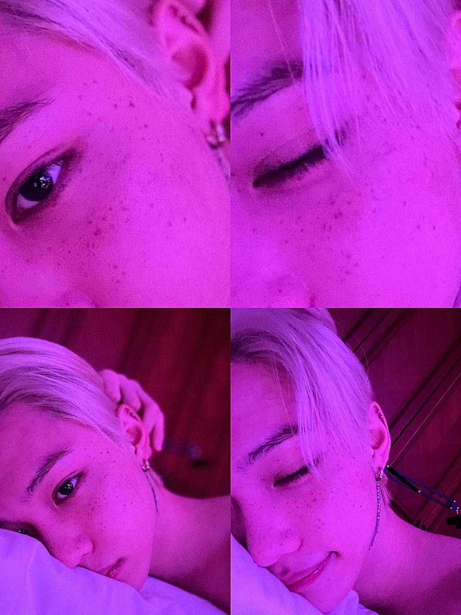 lixIoops's tweet image. the freckles-