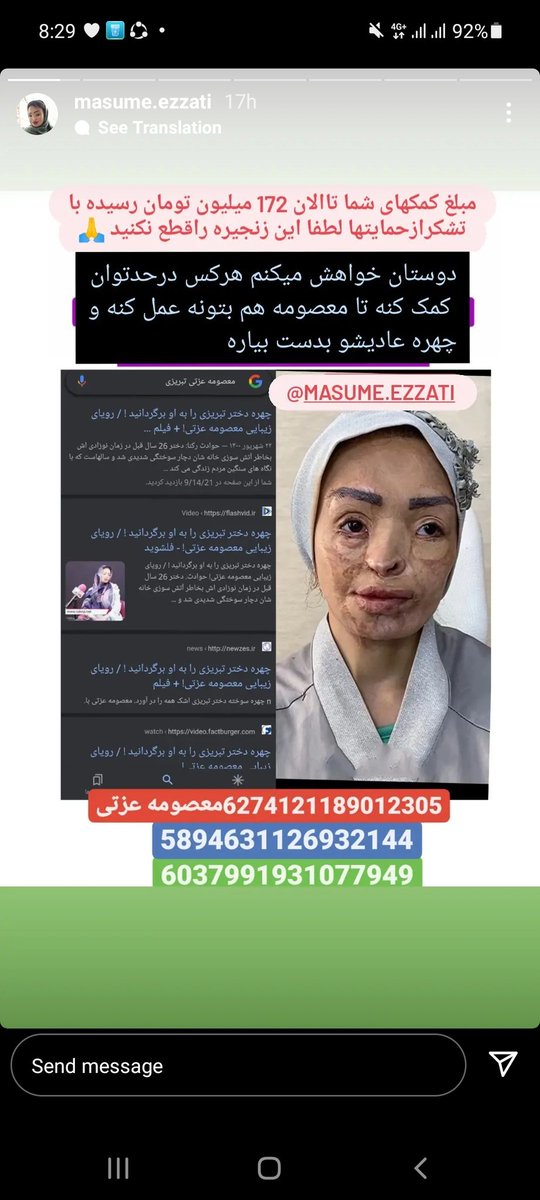 zohreh_zk's tweet photo. توروخدا فرض کنید این عکس هم نوده ریت کنید و اگه میتونید در حد توان "هرچند کم" کمک کنید شاید زندگی یه نفر تغییر کنه https://t.co/PpZIRBnqGe