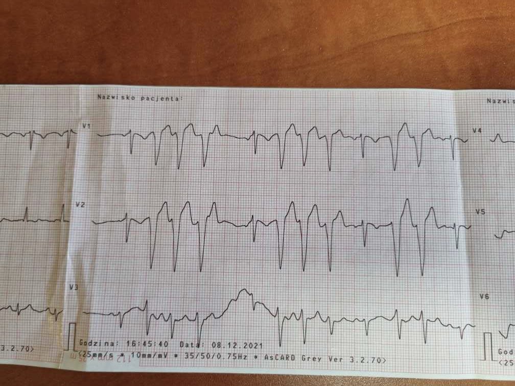 szczasny tweet media