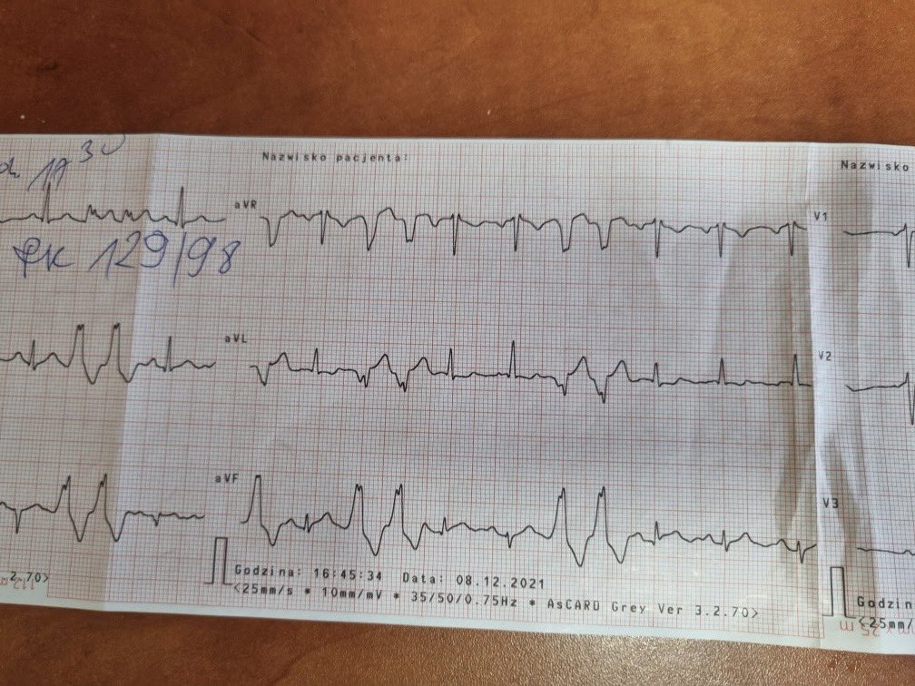 szczasny tweet media