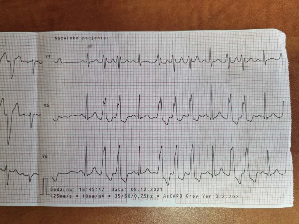 szczasny tweet media