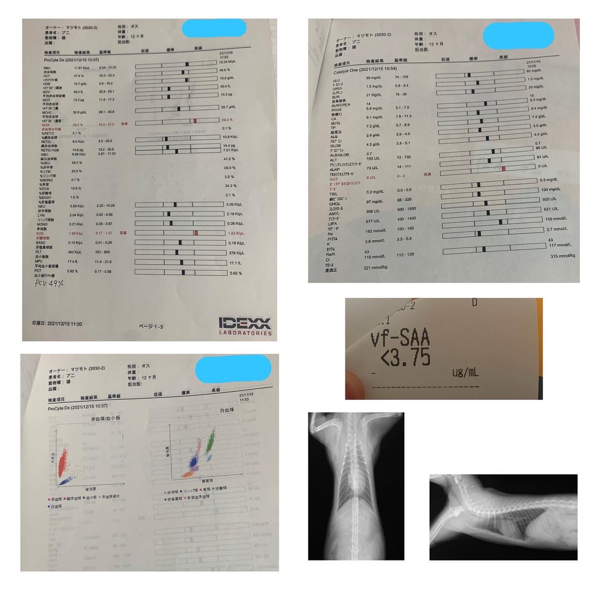 お久しぶりです🙇‍♀️
ご報告が遅くなりすみません🙇‍♀️🙇‍♀️
15日に3ヶ月後の検査に行ってきました🚗 🏥
現時点では再発等見られず大丈夫でした💯 🙆✨
外注検査の結果が分かり次第ご報告致します🙇‍♀️
このまま無事寛解出来ますように🌟🙏
