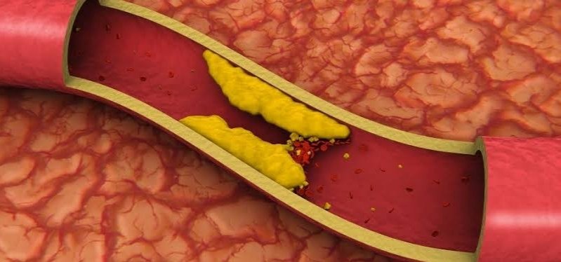 Damar tıkanıklığı hayati risk taşıyan bir hastalıktır. Tıkanan damarın bölgesine göre farklı belirtiler meydana gelir. Beyin, kalp ve bacak gibi pek çok bölgede tıkanıklık yaşanabilir.

Erken tanı hayat kurtarır!👇 
danisanapp.com/goapp
