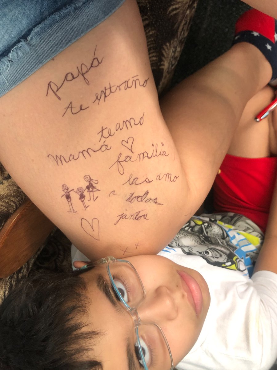 AliuskaCedeno's tweet photo. Estos son los sentimientos de mi hijo plasmados en este momento en mi piel,no más injusticia merecemos estar con nuestra familia juntos:ESCÚCHENNOS QUEREMOS RESPUESTAS 
#ir1ir2ir5cr1cr2visaeua 
@SenRubioPress 
@EmbassyGuyana 
@RepMariaSalazar 
@POTUS 
@holaotaola
@alexotaola https://t.co/A0nPujqjkk