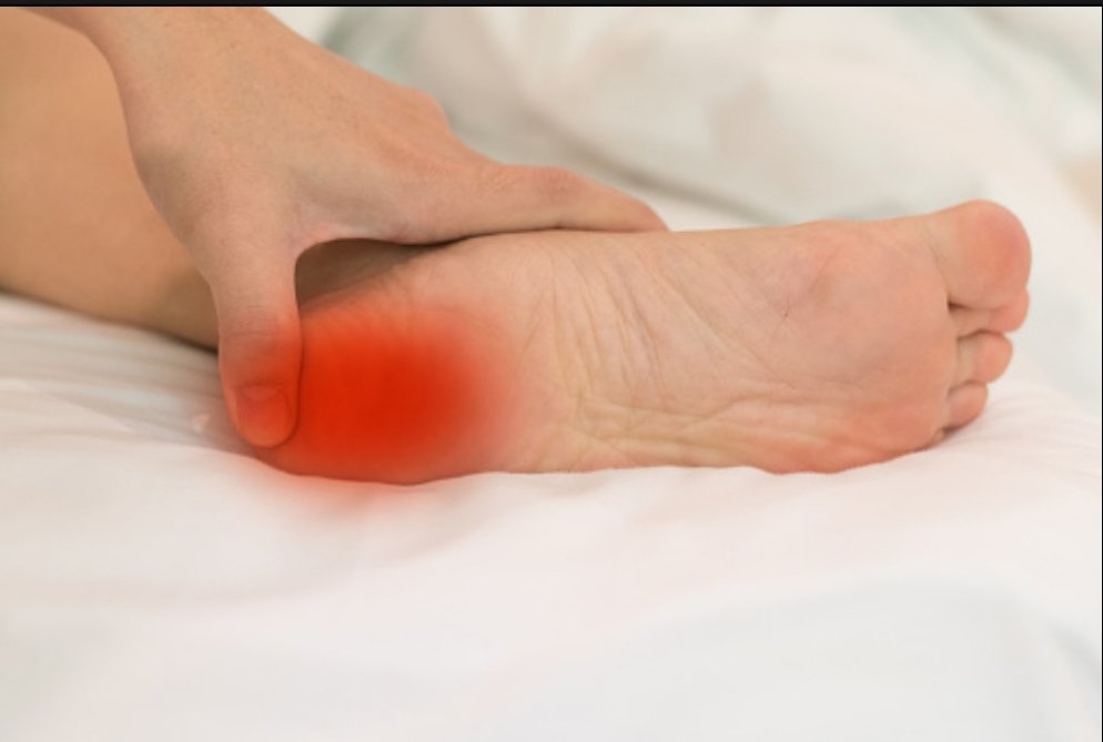 Синдром тарзального канала стопы. Защемление пятки. Болит пятка на левой ноге. Туннельный синдром голеностопного сустава. Подошвенный (плантарный) фасциит.