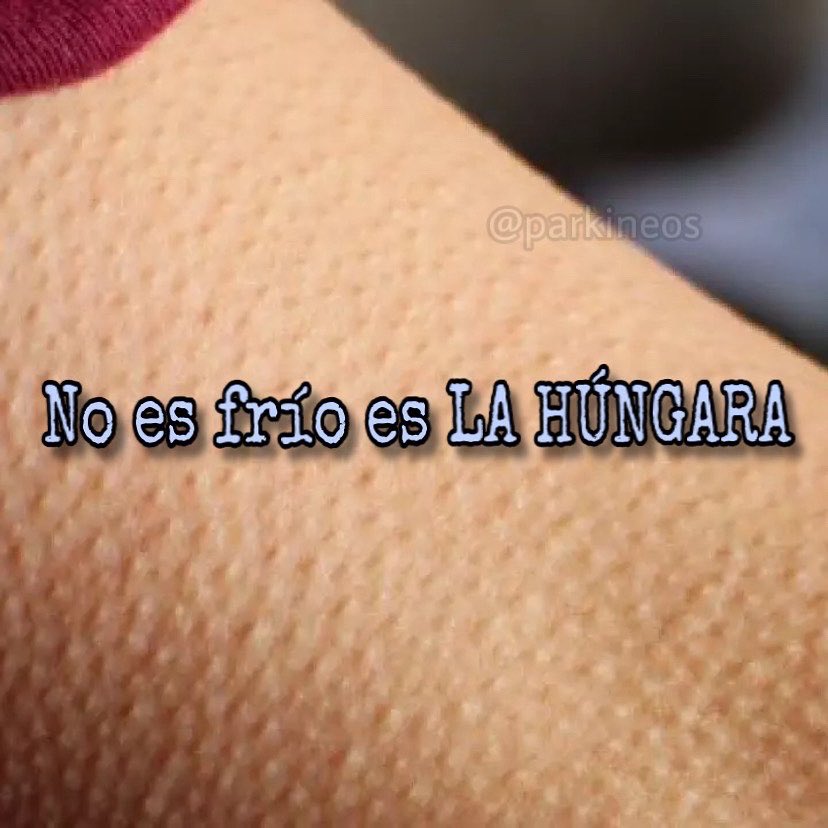 parkineos tweet media