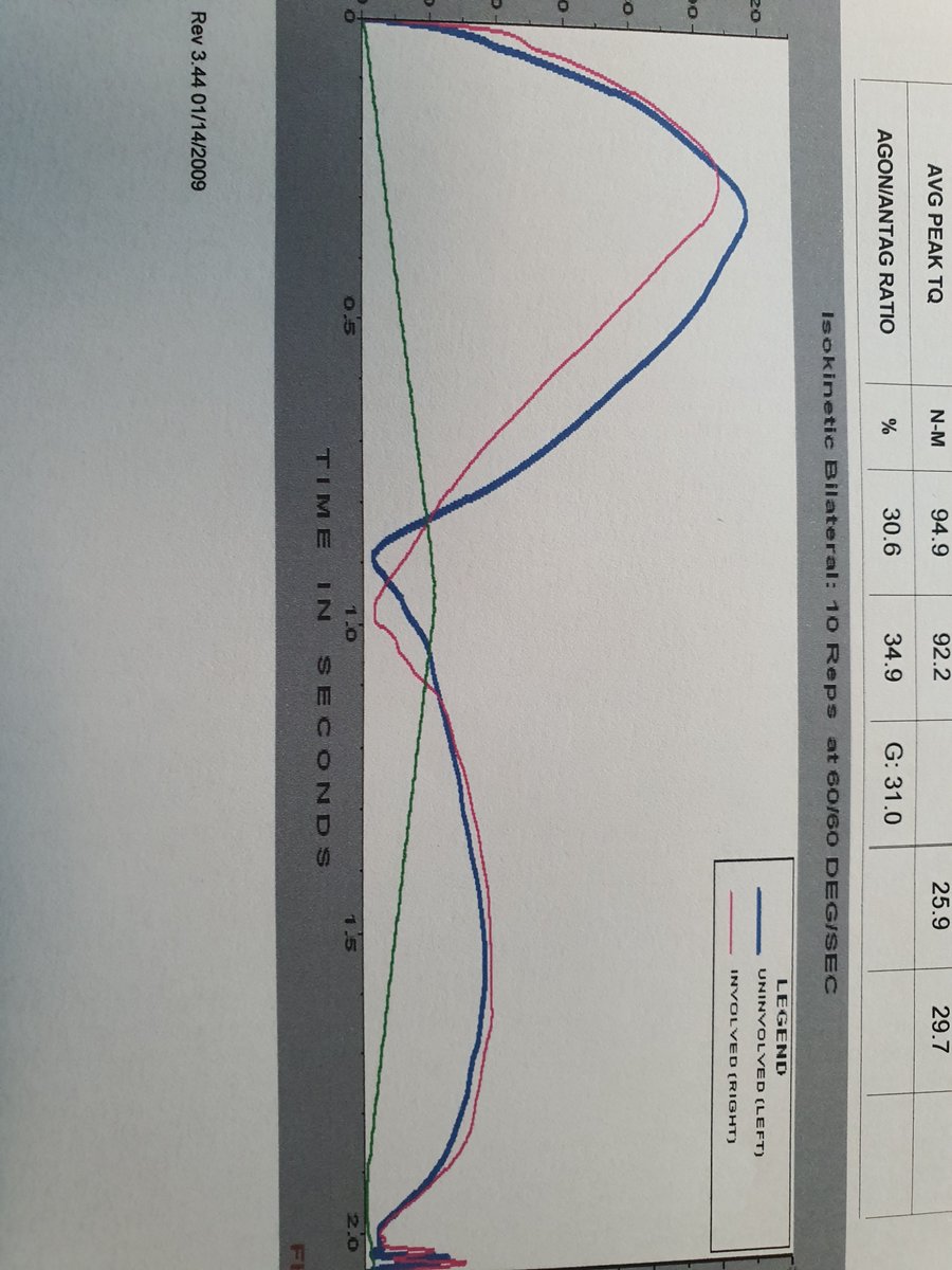 AspetarAbassi's tweet photo. @PdHooghe Wonderful Dr Pieter!  Goid job ! One team one dream 
This is a result of the Nice recovery of open repair 6 M post op ! Great Peak torque similar to the uminvolved in time and value! Dorsiflexors strength restored meaning good ago- antago ratio as shown here
Tested Prone https://t.co/yaCt5BD8Mz