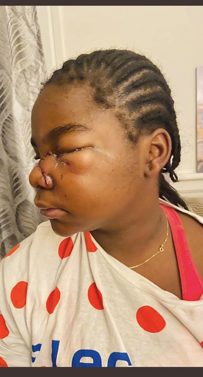 sarahfrikh's tweet image. #AnnaChloe tu n’es plus seule, nous sommes nombreux derrière toi maintenant !
Honte à son école, honte aux enseignants. J’espère qu’il y aura des condamnations !
Soutien total 🙏❤️
#HarcelementScolaire #racisme