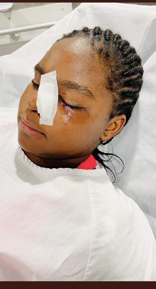 sarahfrikh's tweet image. #AnnaChloe tu n’es plus seule, nous sommes nombreux derrière toi maintenant !
Honte à son école, honte aux enseignants. J’espère qu’il y aura des condamnations !
Soutien total 🙏❤️
#HarcelementScolaire #racisme