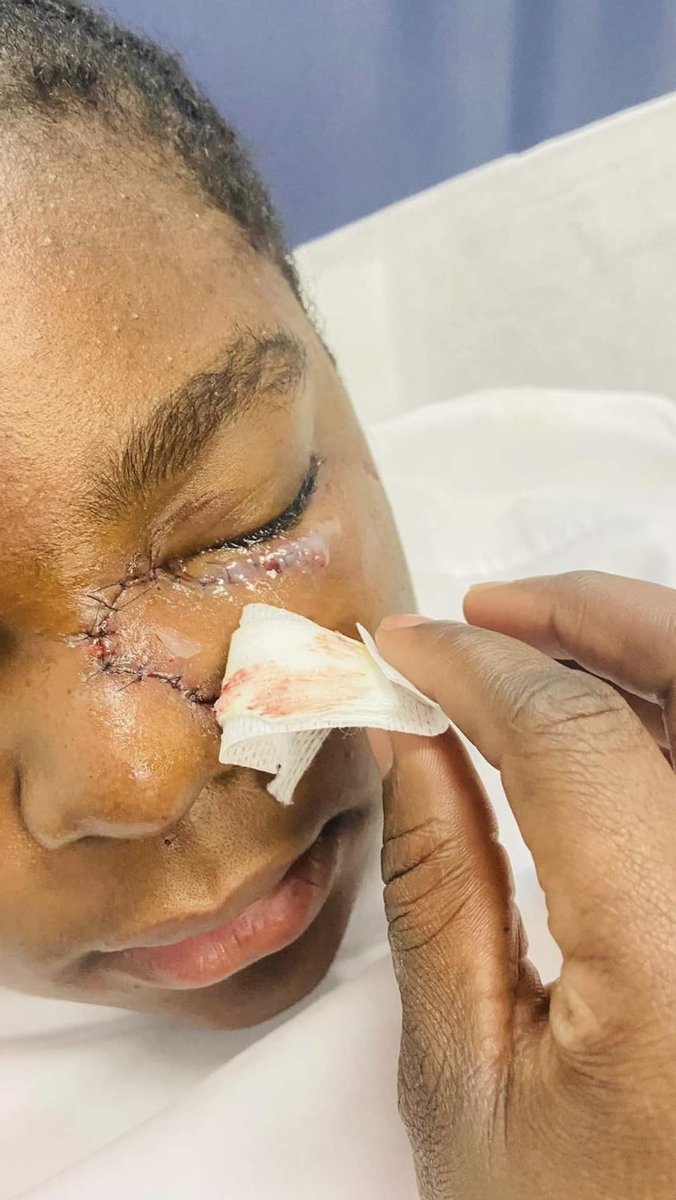 sarahfrikh's tweet image. #AnnaChloe tu n’es plus seule, nous sommes nombreux derrière toi maintenant !
Honte à son école, honte aux enseignants. J’espère qu’il y aura des condamnations !
Soutien total 🙏❤️
#HarcelementScolaire #racisme