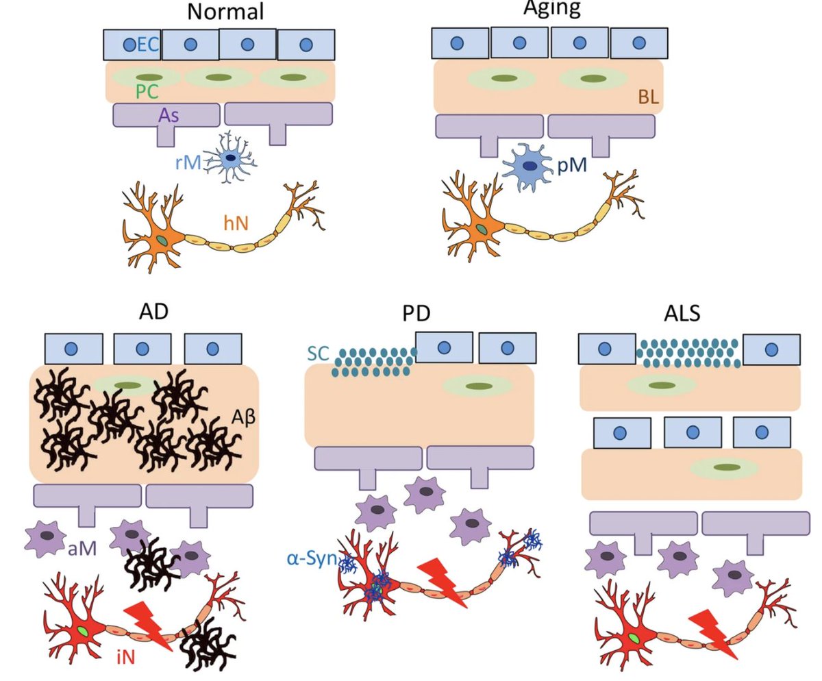 MolNeuro's tweet photo. 'Basal lamina changes in #neurodegenerative disorders'

#bloodbrainbarrier @UGAPharmacy @TulaneMedicine @USFHealthMed

https://t.co/OmVUy9fhmV https://t.co/PZgmc8Ulo6