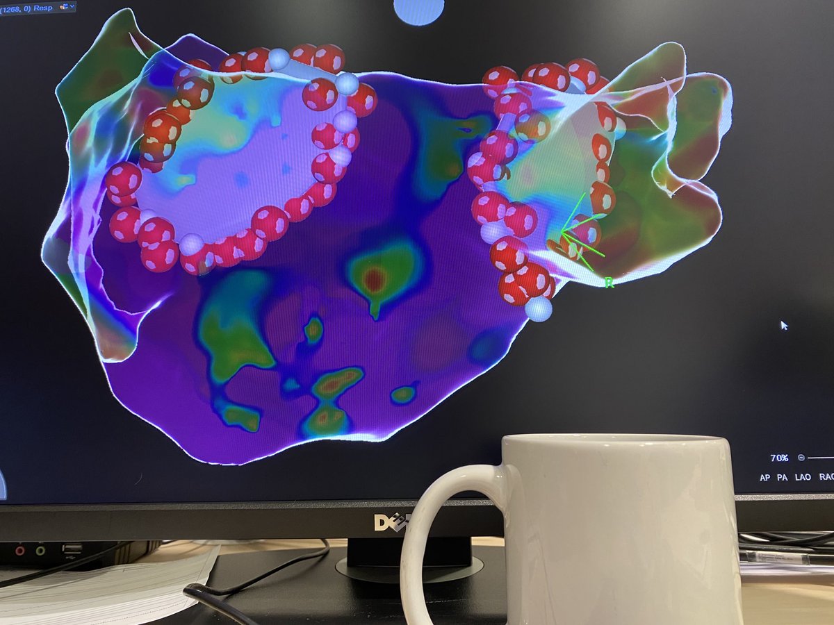 #QDot➕⁦<a href="/HdzNrw/">HDZ NRW</a>⁩… and the ☕️ is still warm after 1:45min for the RPVs and 2:01min for the LPVs ⚡️⚡️⚡️ ⁦<a href="/Phiso_de/">Philipp Sommer</a>⁩ ⁦<a href="/ChristianHeeger/">Christian-H. Heeger</a>⁩ ⁦<a href="/Leonard_Bergau/">Leonard Bergau</a>⁩ ⁦<a href="/MoneebKhalaph/">Moneeb Khalaph</a>⁩ ⁦<a href="/RolandTilz/">Roland Tilz</a>⁩ ⁦<a href="/AGEP_DGK/">AGEP</a>⁩