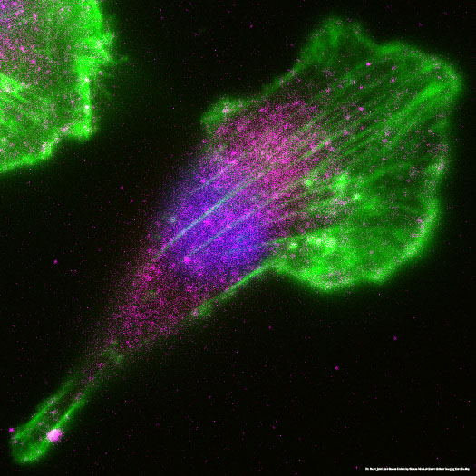 New research identifies exosome-mediated cross-talk between #BreastCancer cells and fat cells altered by insulin resistance – potentially explaining the link between breast cancer #metastasis and conditions like #type2diabetes. 
<a href="/GdenisBoston/">Gerald Denis</a> <a href="/The_BMC/">Boston Medical Center</a> fcld.ly/246hx5c