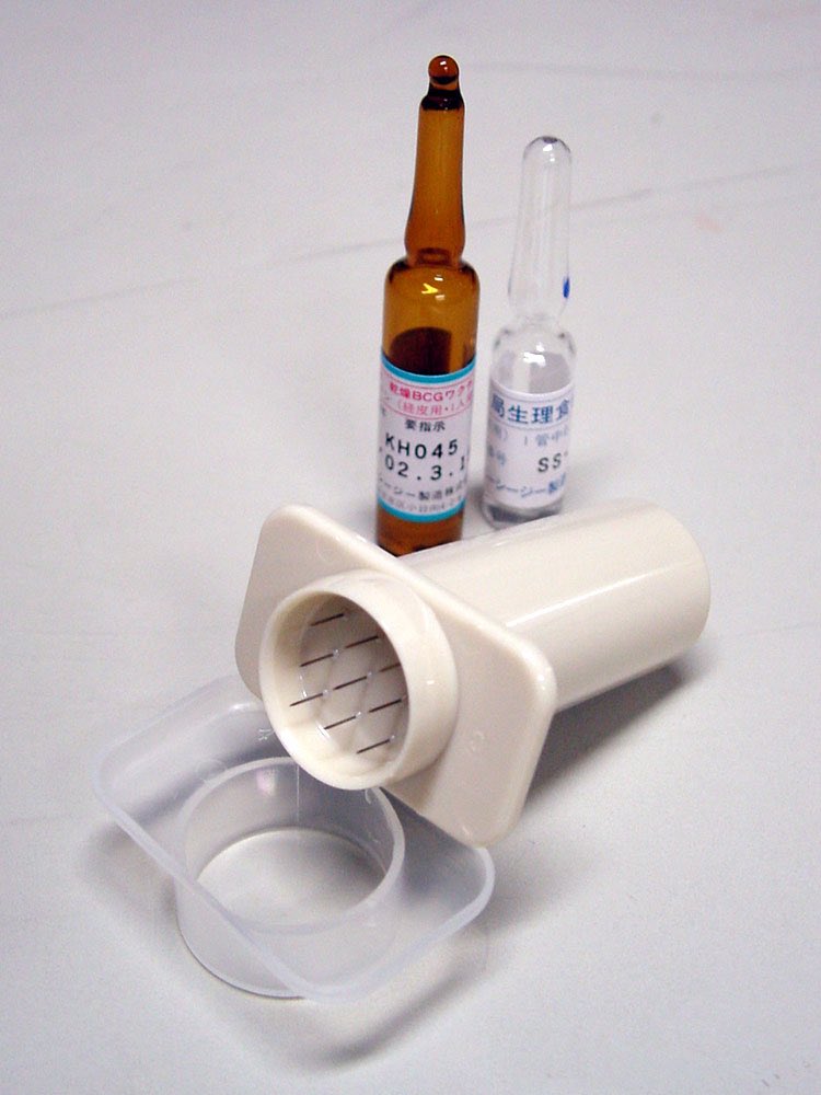 iOSDevEric's tweet image. My daughter got a tuberculosis vaccine and it left a strange looking stamp mark on her arm. The syringe that they use is pretty intense looking.