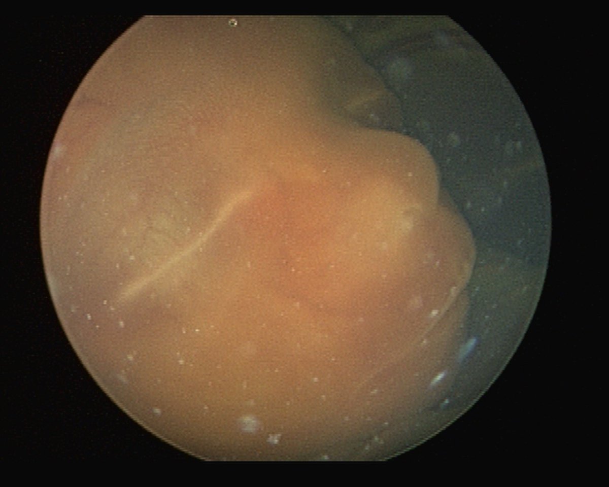 The Fetal Center tweet media