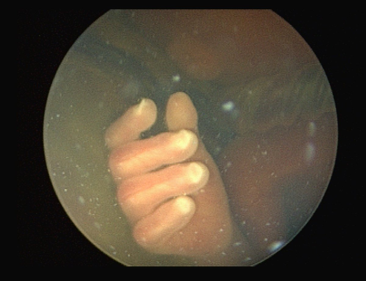 The Fetal Center tweet media