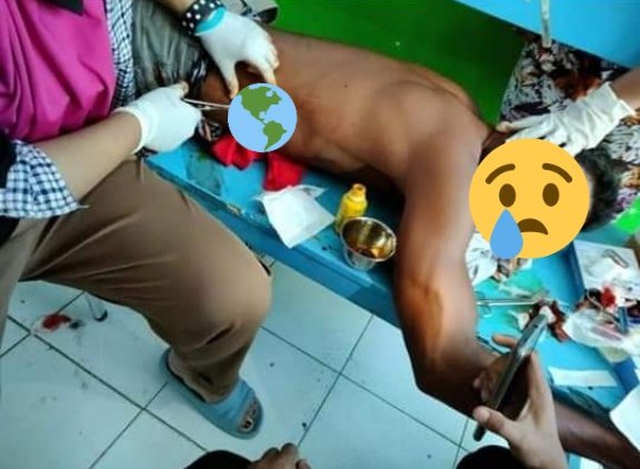 mazzini_gsp's tweet photo. ⚠️Warga sipil ditembaki oleh aparat Kepolisian. 18 korban warga sipil mengalami luka berat dan ringan ⚠️
Lokasi di Negeri Tamilouw, Kecamatan Amahai, Maluku Tengah. Peristiwa terjadi hari ini, Selasa tanggal 7 Desember 2021 sekitar pukul 05.20 WIT. https://t.co/LF0JaxAM5U https://t.co/N266EFUHYt