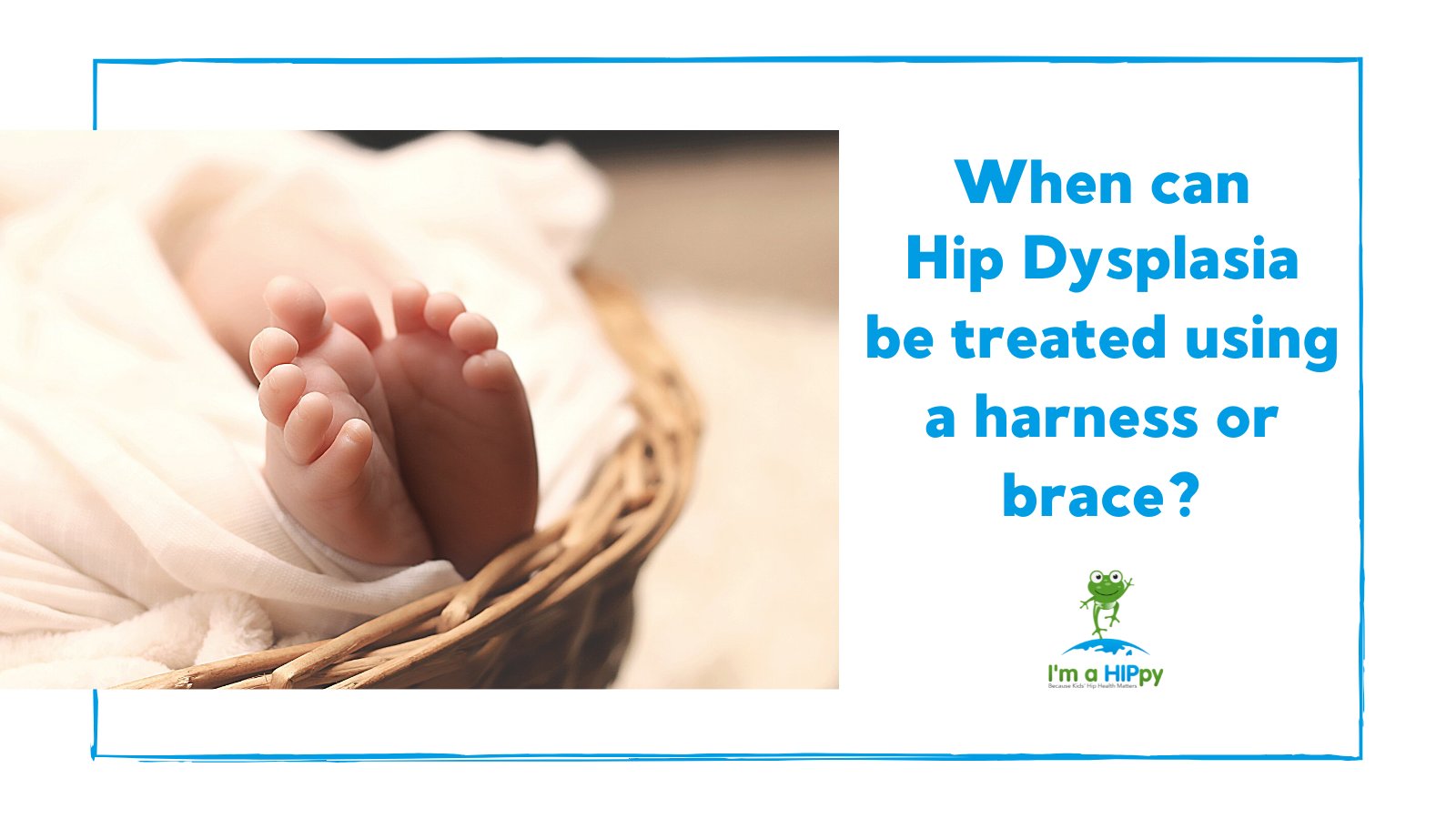 hip dysplasia in babies brace