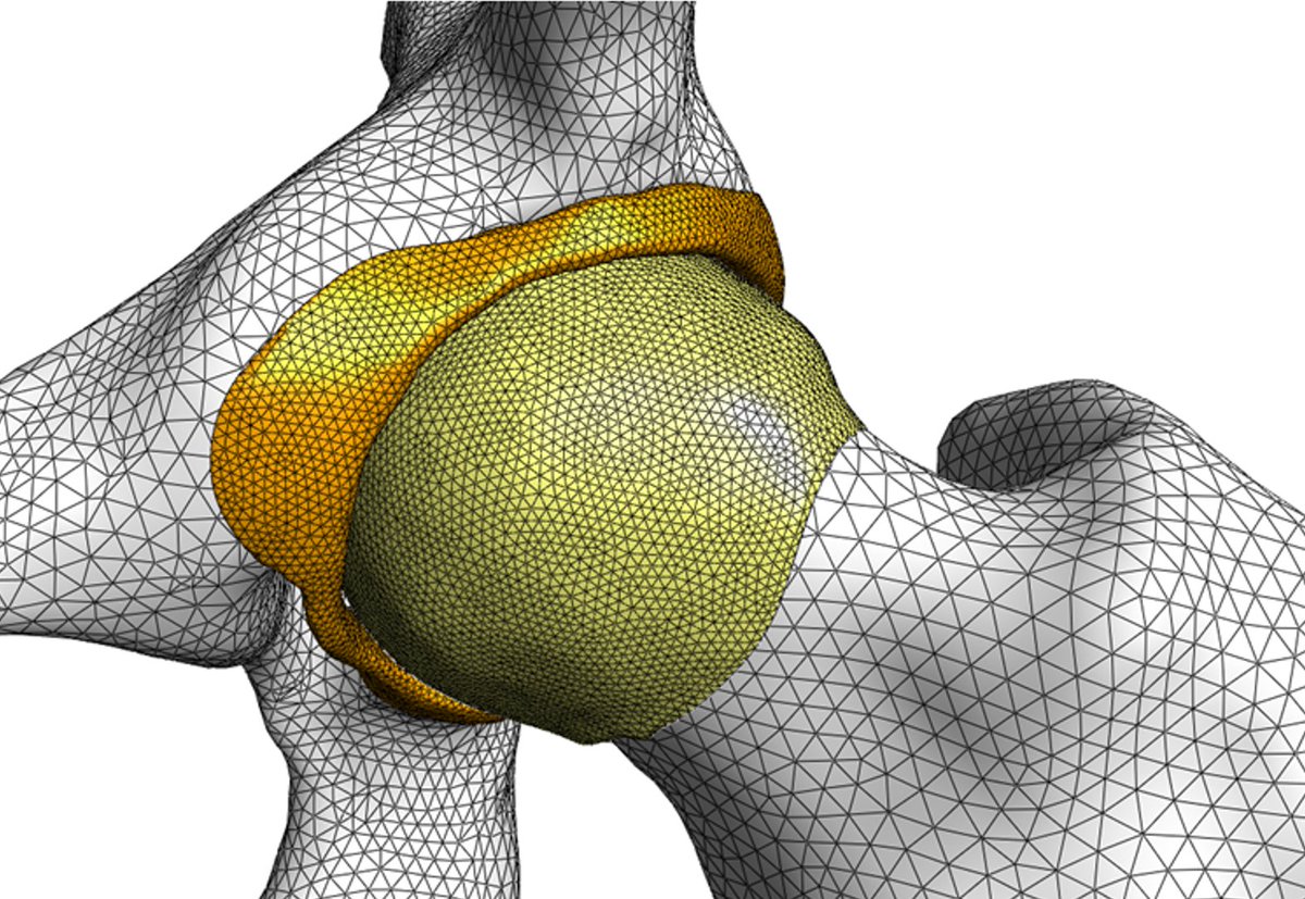 Jeff Weiss (@jeffweissut) on Twitter photo Pleased to share <a href="/jocelyn__todd/">Jocelyn Todd</a>'s final manuscript from her PhD research, recently published in Clinical Orthopaedics and Related Research! Jocelyn examined how chondrolabral damage and labral repair influence the mechanics of hips with cam morphology: bit.ly/3GkG6bC Pleased to share <a href="/jocelyn__todd/">Jocelyn Todd</a>'s final manuscript from her PhD research, recently published in Clinical Orthopaedics and Related Research! Jocelyn examined how chondrolabral damage and labral repair influence the mechanics of hips with cam morphology: bit.ly/3GkG6bC