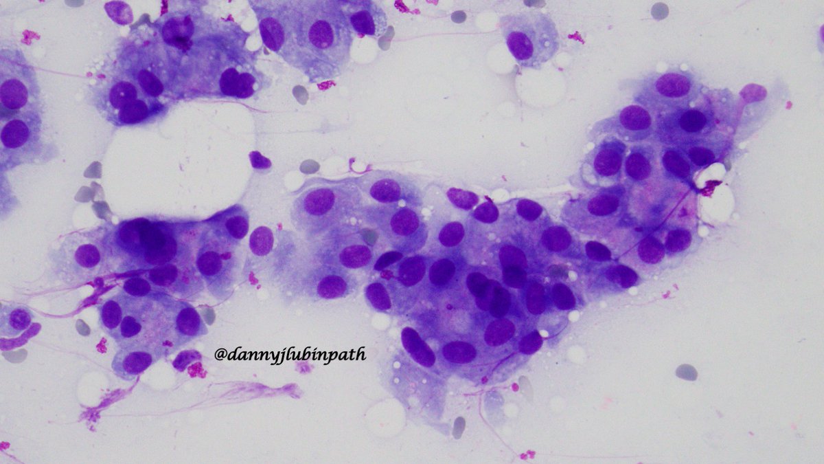 Emory Cytopathology tweet media