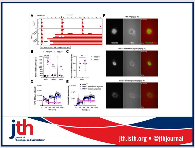 JTHjournal's tweet photo. New article: PAR4 is expressed by various cells, incl MK/ #platelets Lee et al @AntoniakLab @UNC generate PAR4-/-  🐁&amp; show PAR-4 signalling in platelets is critical for arterial and venous #thrombosis and hemostatic plug stability. https://t.co/KdLPMFKeIo https://t.co/uFKI3xNE79