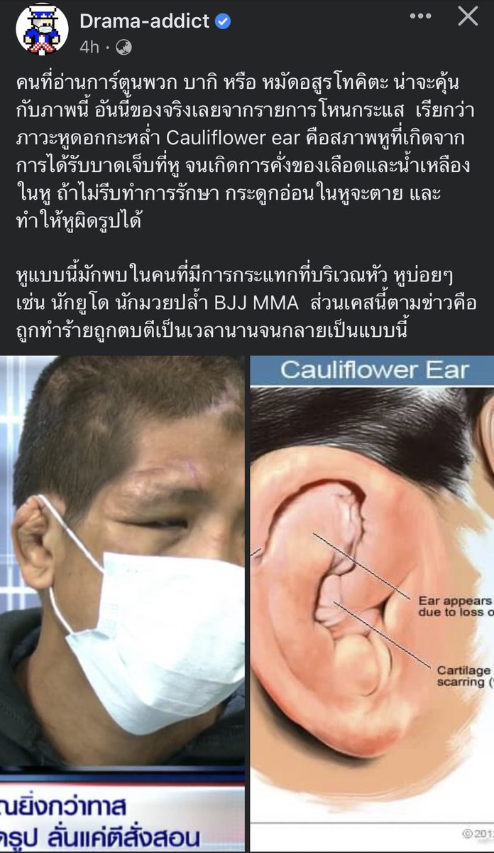 harutososhine's tweet photo. เจอข่าวนี้แล้วหดหู่ไปเลยอะ  ต้องจิตใจต่ำแค่ไหนถึงได้ ทารุณเขาได้ขนาดนี้ พูดตักเตือนก็พอแล้ว นี้ทำร้ายร่างกาย+บังคับกินขี้หมา ขี้แมว ขี้นก  แล้วบาดแผลที่ยิ่งแล้วสลดใจคือ อวัยวะเพศเขาสภาพแผลเน่าไปแล้ว  ส่วนที่ต้องได้รับการดูแลมากสุดคือ สภาพจิตใจสงสารอะจริงๆ #โหนกระเเส https://t.co/nmLYcToH6X