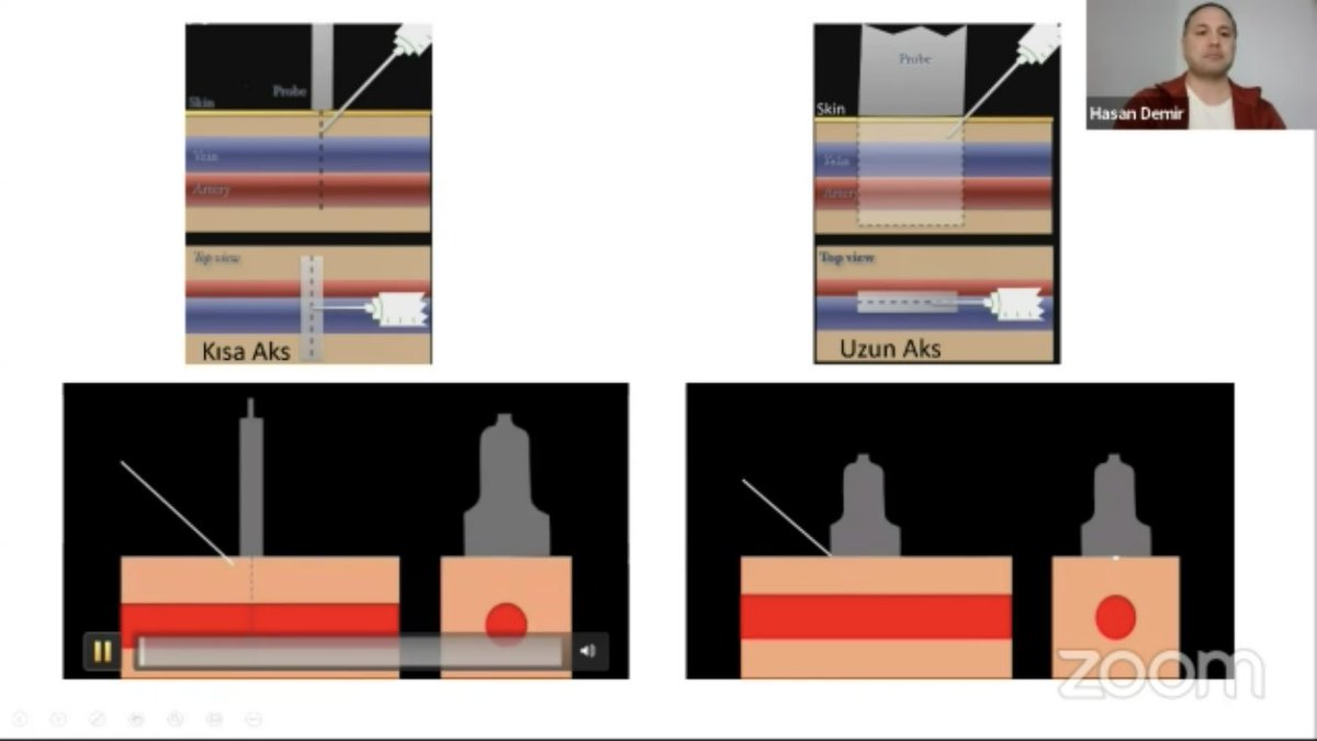 #ÇAK Dr. Hasan Demir sunumuyla devam ediyor! 👉🏻doktorclub.com/cak <a href="/CAK_online/">Çarşamba Acil Konuşalım✋🏻</a>