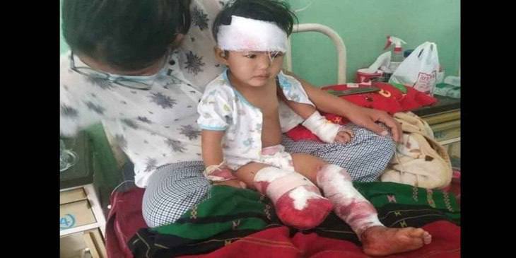 AungHsuwai's tweet photo. A mother was killed by a landmine planted by SAC in Mindat &amp; left her child behind who had a leg amputated &amp; suffered head injuries. That child is in serious condition. #EndImpunity #Dec8Coup  #WhatsHappeningInMyanmar https://t.co/crG069EoXS